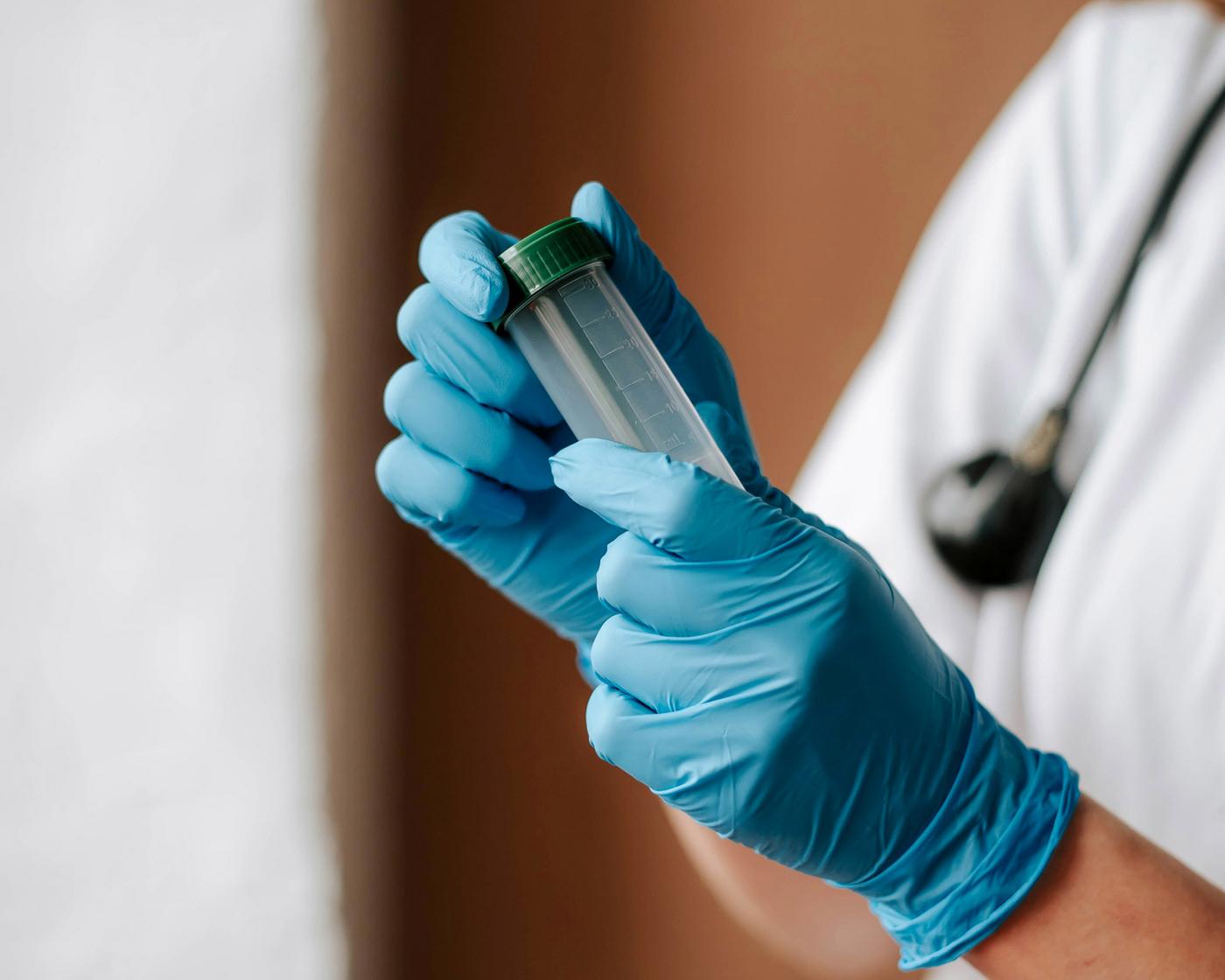 Proberöhrchen in der Hand einer Ärztin mit blauen Handschuhen