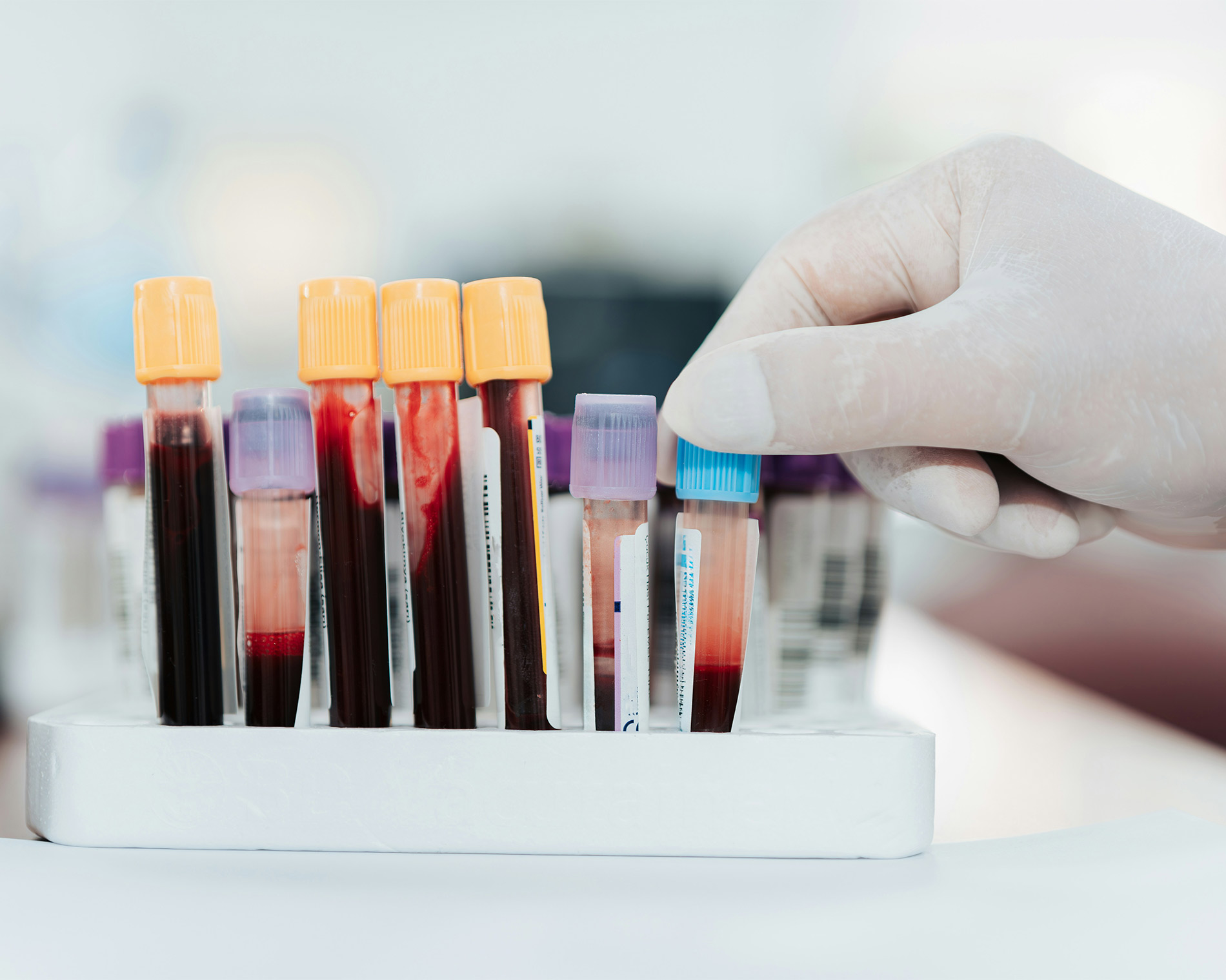 Abgenommenes Blut in länglichen Behältnissen für das Labor